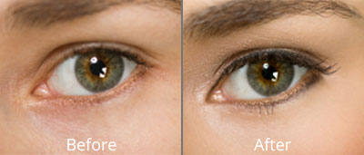 Permanent Makeup Before and Afters in Darien CT at Versailles Medical Spa